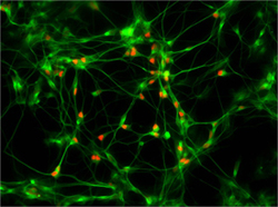 iPS-derived_motor_neurons